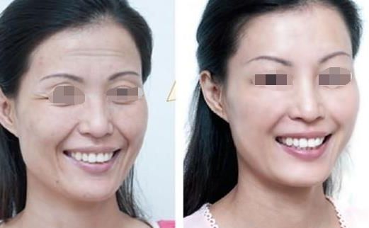 武漢魚尾紋整形美容醫(yī)院口碑榜：告別皺紋困擾，綻放青春光彩