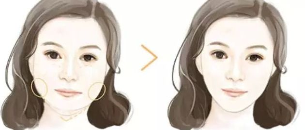 上海韓鏡整形醫(yī)院磨骨效果如何？專家力薦！服務(wù)價(jià)格一覽，趕快留意！