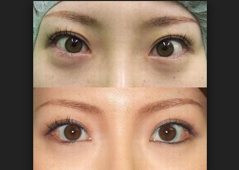 寧波面頰凹陷填充口碑前十名醫(yī)美機構指南