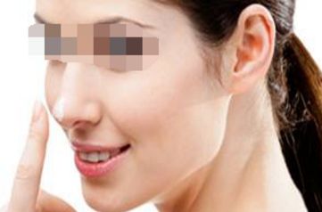 重慶射頻微針祛除木偶紋：權(quán)威醫(yī)院推薦