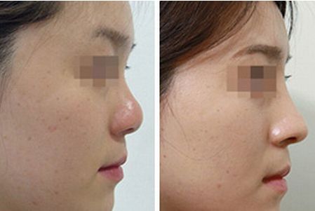 濟(jì)南印第安紋修復(fù)醫(yī)院口碑排名前十強(qiáng)詳解！