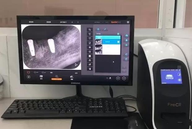 鞍山時代口腔門診部_丹麥fire CR數(shù)字化牙片