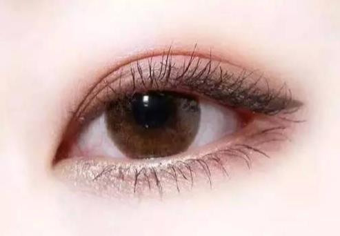 徐州做雙眼皮多少錢？徐州做雙眼皮大概什么價格？