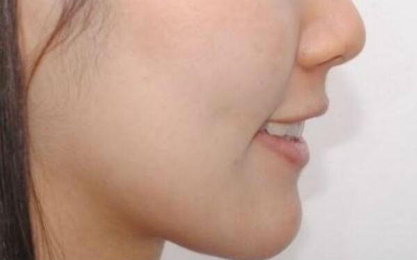 2023長沙鼻子用硅膠隆鼻前10位醫(yī)生口碑榜技術(shù)實力強，口碑好！周光杰、王曉朋、侯道性價比超高！