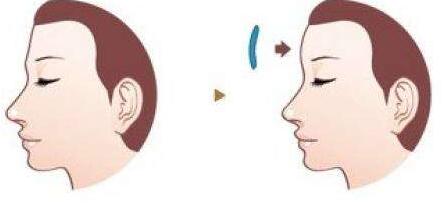 2023合肥超導光波治咖啡斑前十強醫(yī)生強榜均是實力派！楊松、王維堂、金翰成實力盤點推薦