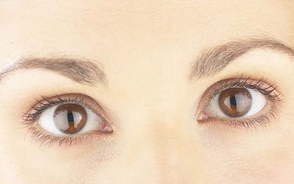 撫順注射膠原蛋白去川字紋醫(yī)生