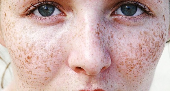 2023石家莊埋線提升眼角紋醫(yī)生排行榜前十位哪家實(shí)力贊，趙亞平、姚春麗、高慧權(quán)威有保證，整形更放心