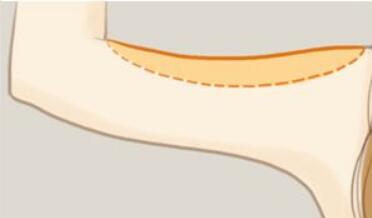 2023達(dá)州射頻祛動(dòng)態(tài)細(xì)紋排行榜top10強(qiáng)的醫(yī)生匯總表！陳朝政、鄧偉、茍文口碑技術(shù)在線，強(qiáng)烈推薦