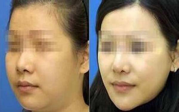 2023昆明皮秒去動態(tài)細紋醫(yī)生前10口碑榜人氣盤點！趙雷、肖軍磊、高鍔口碑好，放心選！