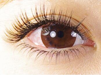 合肥飛秒祛雀斑醫(yī)生