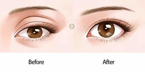 重慶光電去唇紋醫(yī)生