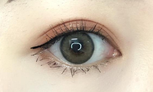 南京負壓去黑頭醫(yī)生