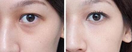 大同錯(cuò)頜畸形矯正醫(yī)生