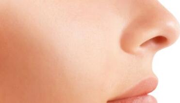 蘇州拉皮剝離醫(yī)生