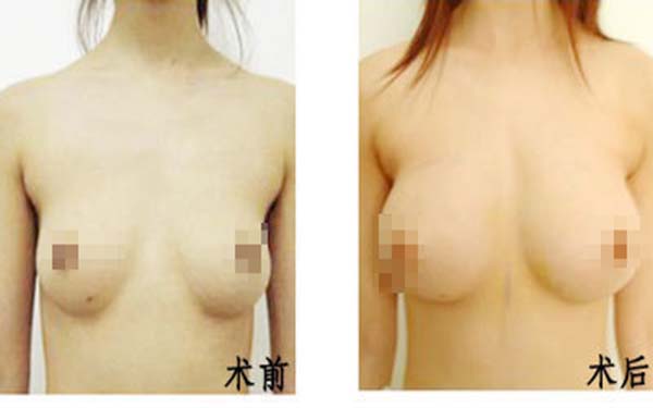 2023武漢光纖去除魚尾紋正規(guī)醫(yī)生評價前十位大全必看！雷云飛、王雨程、石萍口碑實力沒一個差的