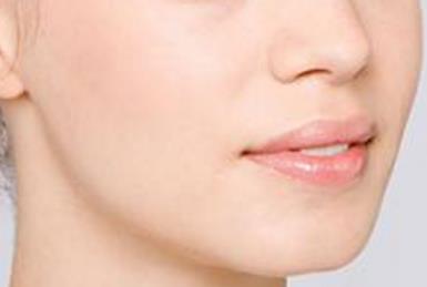 2023慈溪祛除唇紋權(quán)威醫(yī)生排名榜前幾官方公布！吳仁欽、高孟飛、甄毓玲整友選擇多