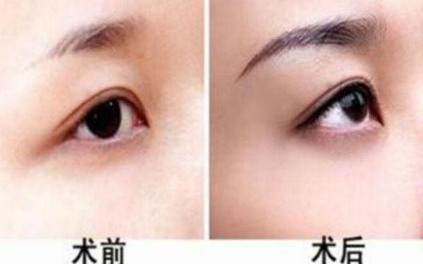 2023上海鐳射激光祛斑醫(yī)生排名榜top10強哪個比較好？李宏毅、陳玉琴、曹芳讓我們一起來看看