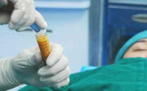 2023無錫自體脂肪填充隆鼻醫(yī)生評分TOP10強評價怎么樣？劉茜、王忠志、韓德昌便宜又好