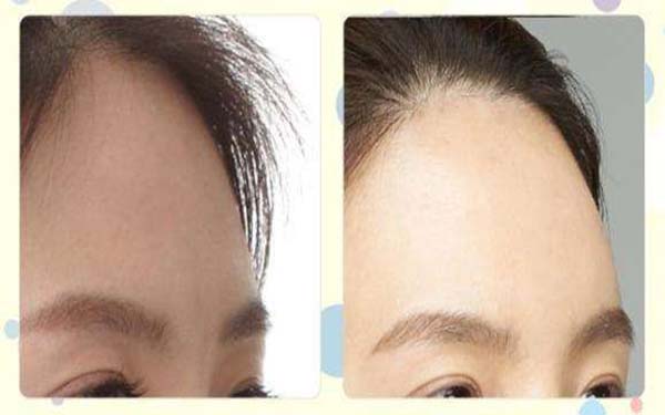 2023南京胸部硅膠填充醫(yī)生排名前10名值得觀望！黎秀、袁永、曾茂技術(shù)水平讓人驚嘆！