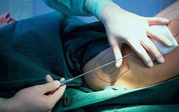 2023成都嗨體填充上眼眶醫(yī)生排行前10大評比！蔡時安、徐進(jìn)、李楊實(shí)力值得信賴