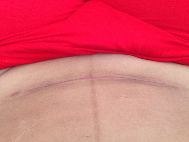 2023泰州微創(chuàng)切眉術(shù)醫(yī)生口碑榜前十名最新答疑！王英勇、劉志靜、黃娜公立僅一家