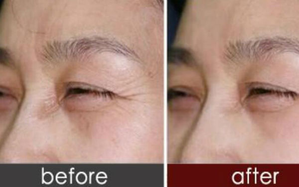 2023南京超皮秒去唇紋醫(yī)生前10名排行榜名單上線！李智明、侯范金、張讓虎正規(guī)權(quán)威推薦