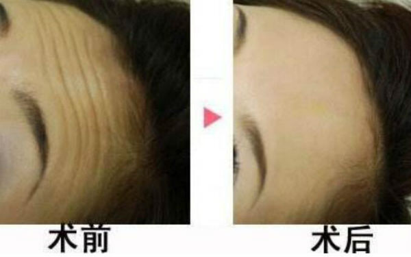 2023蘇州激光洗紋身前十位醫(yī)生強(qiáng)榜齊聚-推薦！武彬、顧浩、邵宏實(shí)力、口碑有目共睹