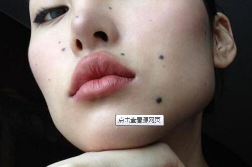 淮安臉部抽脂大醫(yī)生