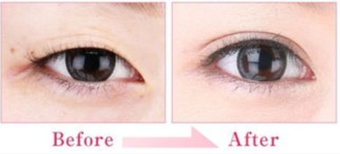 2023南京下巴截骨術(shù)醫(yī)生榜單前幾實(shí)力清單揭曉！李明鐘、張世幸、易永祥實(shí)力口碑都不差