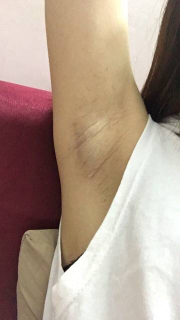 2023寧波射頻去除魚尾紋醫(yī)生排名榜前10大眾選舉！李霞、劉興達、金卓為正規(guī)靠譜名氣大