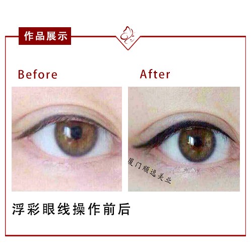 2023東莞額頭去細紋正規(guī)醫(yī)生評分前十位今日盤點！熊科明、何嵐、周炎宏一覽