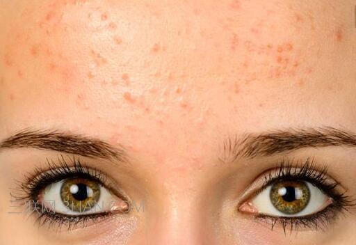 2023蘇州做假體隆鼻修復(fù)排行醫(yī)生專家橫評(píng)，聶志宏、周仙云、周志敏熱門專家遠(yuǎn)近聞名