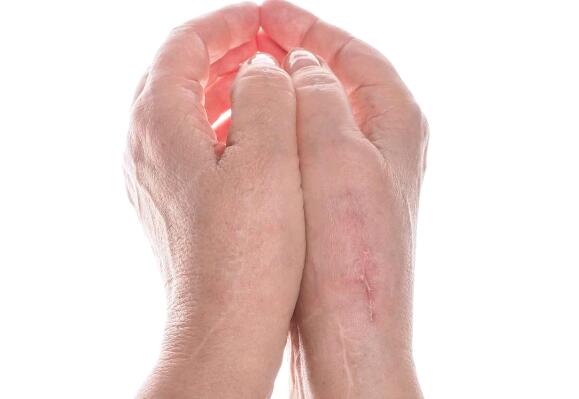 衢州消除淚溝醫(yī)生