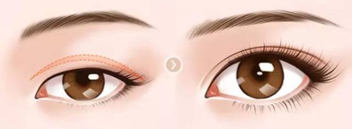 2023蕭山微整面部皺紋排名top10強(qiáng)醫(yī)生針不戳駱蘇嬌、喬剛、秦瑞雨實(shí)力優(yōu)異，值得信賴！