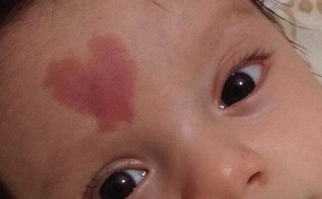 2023北京激光祛疤復發(fā)前10專家強榜口碑好的供你挑選！鄧志文、蔣亞楠、秦小鵬都是高人氣醫(yī)生！