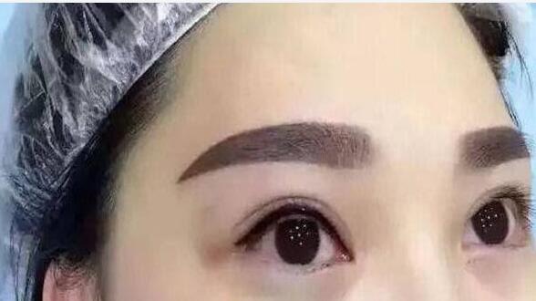 2023寧波光纖溶脂瘦臉大正規(guī)專家上榜TOP10強(qiáng)全新預(yù)評(píng)！王國(guó)尚、方振玉、劉成林老牌醫(yī)生口碑出眾！