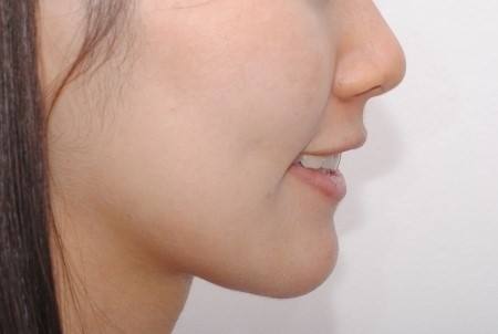 2023蕪湖水動力抽脂瘦肚子專家前十強(qiáng)口碑榜新版一覽！趙曉蘭、侍志強(qiáng)、楊平都被大家熟知