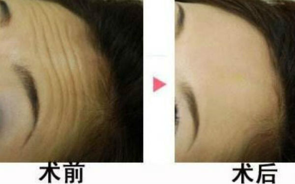 2023襄陽面部激光溶脂正規(guī)醫(yī)生上榜前幾強強來襲！涂文浩、鐘磊、胡勤修實力強勁更安心