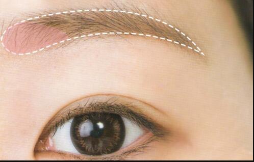 2023海口射頻去妊娠紋醫(yī)生精選前10位哪些效果好？袁兆周、張永、陳雙清TOP3實力比拼，個個名氣大！