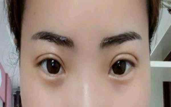 2023義烏小切口祛眼睛細(xì)紋權(quán)威專家排行前十年度匯合！徐斌榮、吳枝香、王業(yè)煒為你保駕護(hù)航！