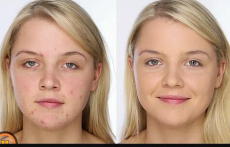 2023廣州無針去頸紋醫(yī)生前10名上榜名單合集公示！黃美興、張鑄、穆大力公立機構醫(yī)生常駐榜單