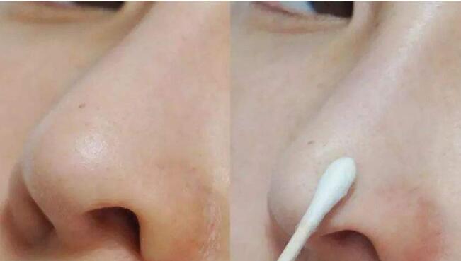 2023益陽(yáng)自體骨隆下巴在榜名單前十專(zhuān)家綜合評(píng)定！丁芷林、劉靜、張彬這幾個(gè)專(zhuān)家名氣都不錯(cuò)！