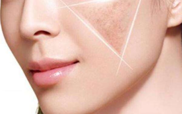 2023日照激光磨皮去手術(shù)疤痕專家口碑TOP10強(qiáng)硬核推薦！張衛(wèi)華、翟朝暉、董子迎實(shí)力口碑跟蹤