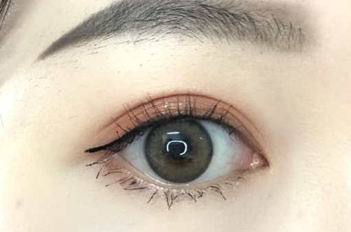 2023無錫電波拉皮去除川字紋正規(guī)專家推薦名氣大！李佳、周子建、于振華值得選擇~