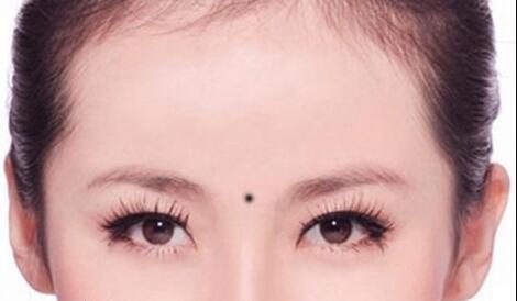 蘇州自體脂肪注射頸部皺紋醫(yī)生