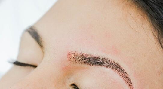 2023連云港額肌瓣懸吊矯正上瞼下垂醫(yī)生排名榜十強(qiáng)已定！童飛、張文軍、張魁資質(zhì)正規(guī)靠譜