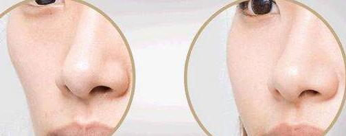 吉林超皮秒祛老年斑治療費用查詢(吉林鐵路醫(yī)院美容科超皮秒祛老年斑參考價:4819元)