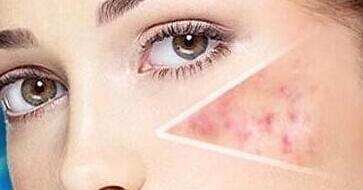 保定微創(chuàng)頸紋價格到底貴不貴(保定第一中心醫(yī)院燒傷整形外科微創(chuàng)頸紋參考價：3689元)