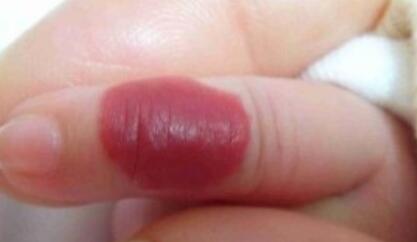 貴陽(yáng)耳朵整形價(jià)格