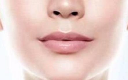 深圳攣縮鼻修復(fù)需要花費(fèi)治療費(fèi)用多少(深圳大學(xué)總醫(yī)院整形美容科攣縮鼻修復(fù)參考價(jià)：4824元)